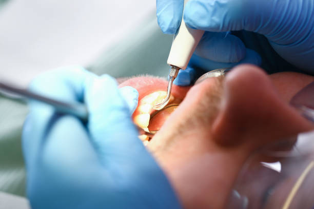 Best Cracked Tooth Emergency Dentist  in Laconia, NH